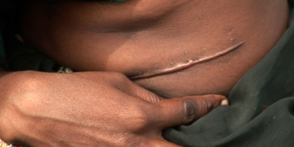 Cuerpos como cajeros automáticos: parados de eeuu venden pelo, órganos o leche materna para salir del atolladero